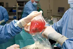 Organ donors’ lives endangered by rushed transplant procedures, investigation finds